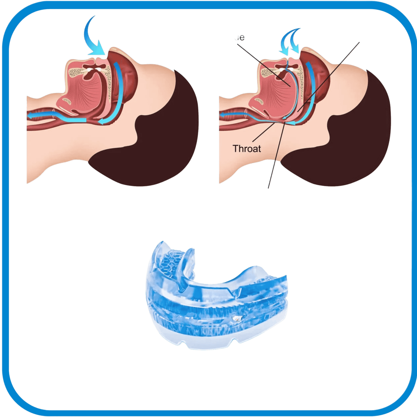 Tappi Bocca Per Dormire (Anti Snoore) - L&G Sport e Benessere 